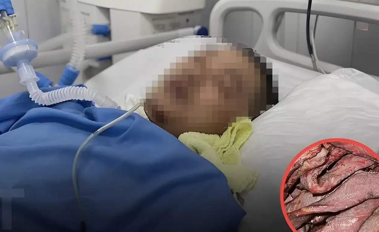 Επεξεργασμένα κρέατα: Ο κρυφός κίνδυνος για καρδιά, εγκέφαλο και αρτηριακή πίεση